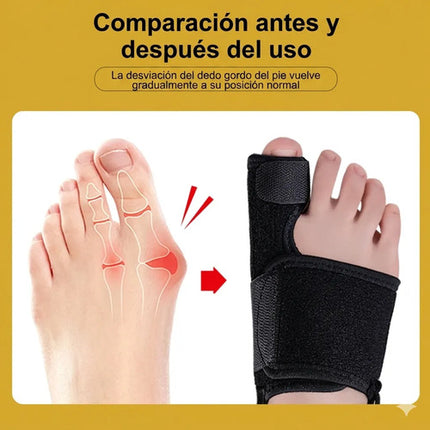 Corrector De Juanete Férula Ortopédica Ajustable Con Varilla