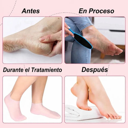 Calcetines De Silicona Hidratacion Para Pies Seco Agrietados