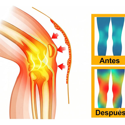 Par Rodilleras Compresion Turmalina Ajenjo Alivio De Dolor